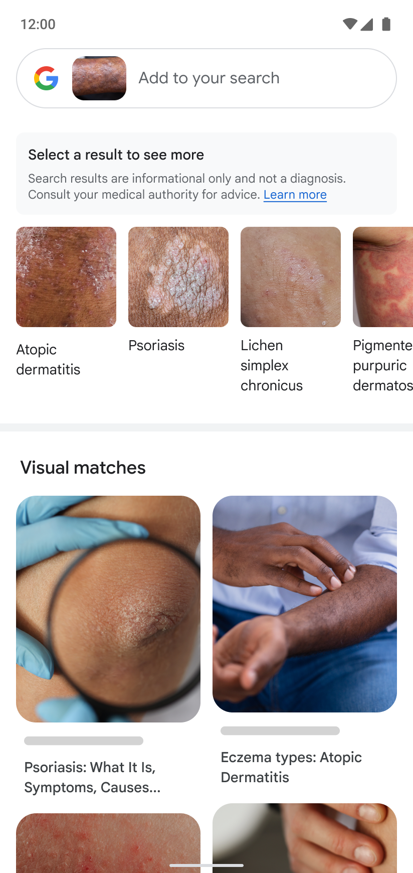 Google Lens现在可以帮助人们比对皮肤健康状况 - EVLIT
